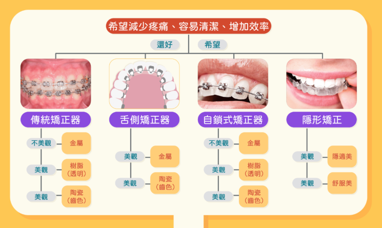 鵬程口腔詳解不同牙箍特點