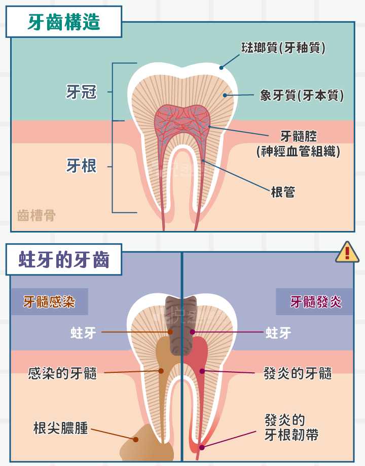 牙齒蛀牙補牙要趁早 | 深圳鵬程口腔連鎖.png